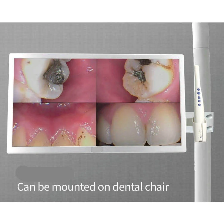 G-M968 intraoral observation detail