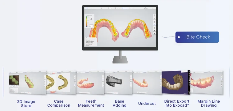 Panda Intraoral Scanner digital case data detail