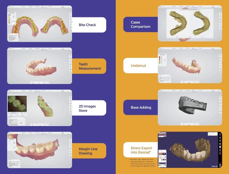 Panda Intraoral Scanner tip and ergonomics detail