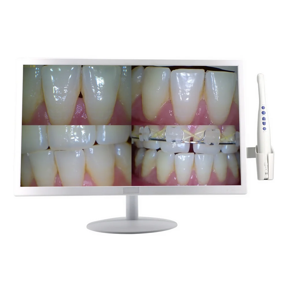 TJ-M968 intraoral observation detail