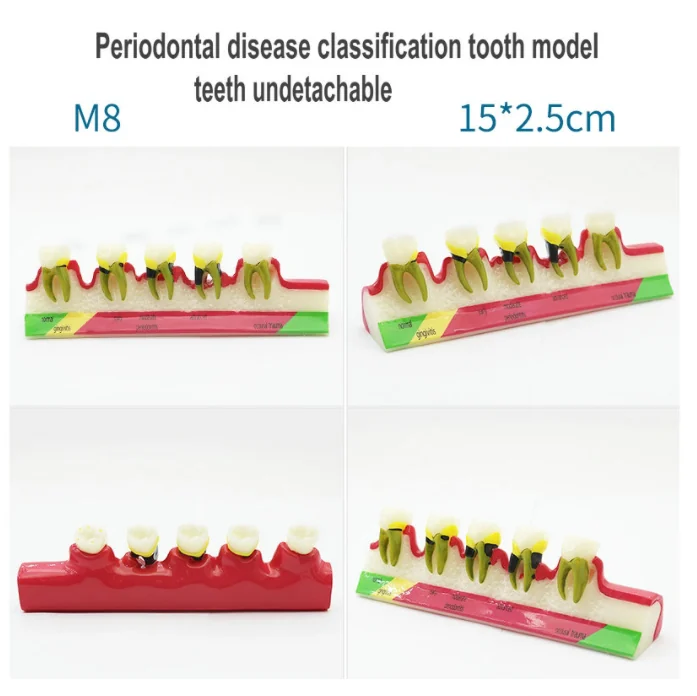 Different model practical structure detail
