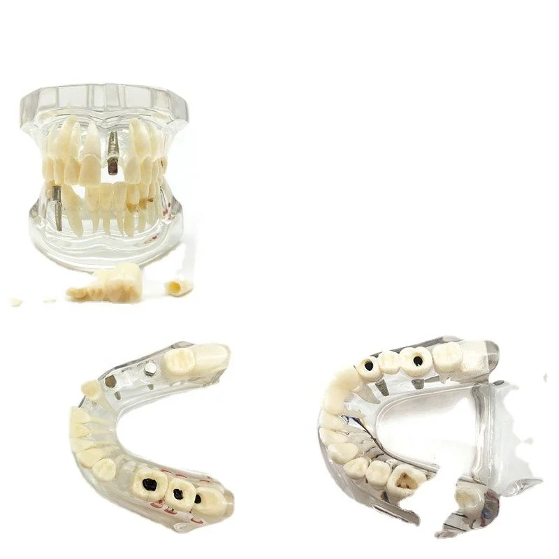 Different model clear application detail