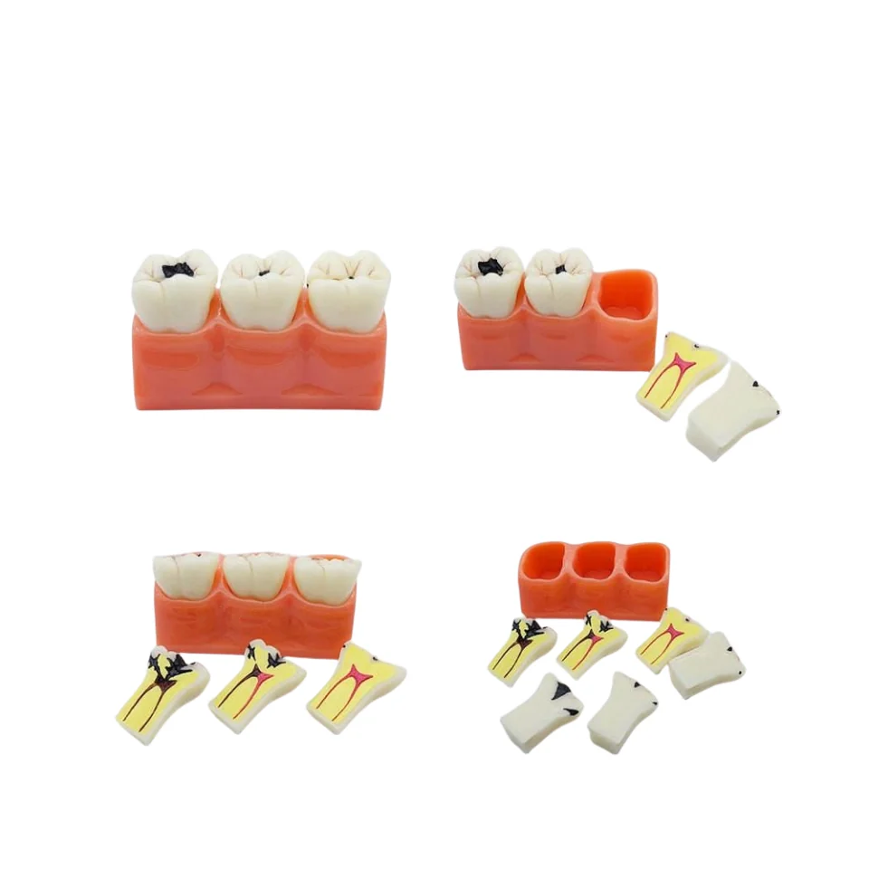 Different model dental laboratory product photo