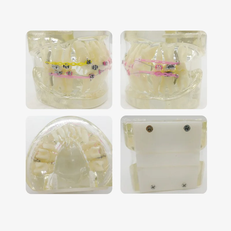 TJ-B2-02 dental teaching model photo