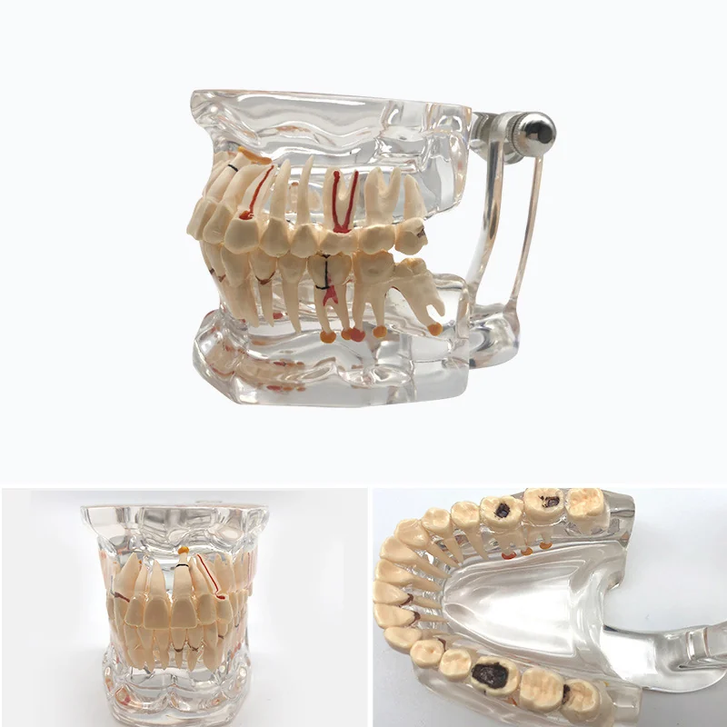 TJ-C1 dental teaching model photo