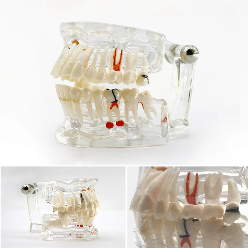 TJ-C2 dental teaching model photo