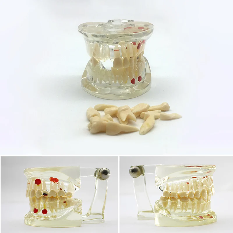 TJ-C3 dental teaching model photo