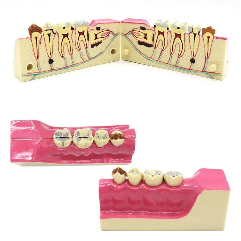 TJ-G22 dental teaching model photo