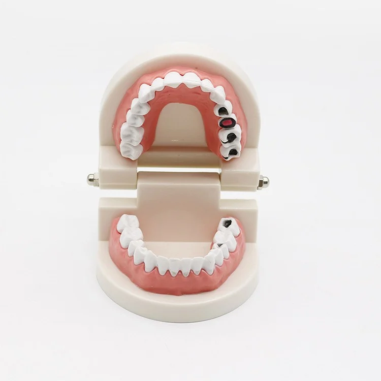 TJ-LY-02 dental teaching model photo