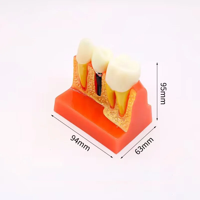 TJ-LY dental teaching model photo
