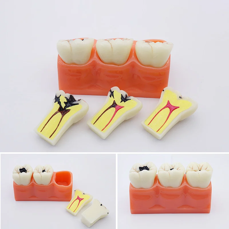 TJ-M1 dental teaching model photo