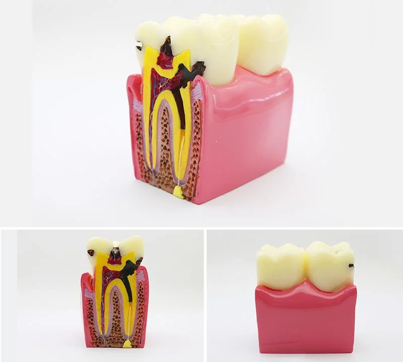 TJ-M2 dental teaching model photo