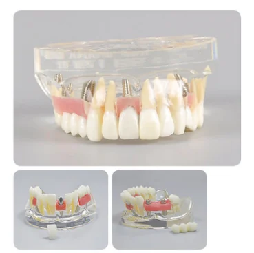 TJ-M2005 dental teaching model photo