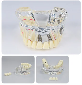 TJ-M2006 dental teaching model photo