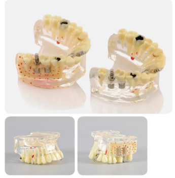 TJ-M2007 dental teaching model photo