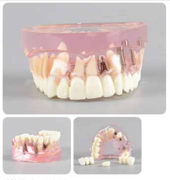 TJ-M2008 dental teaching model photo