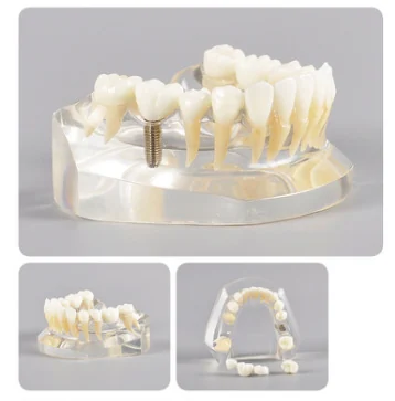 TJ-M2010 dental teaching model photo