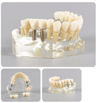 TJ-M2011 dental teaching model photo