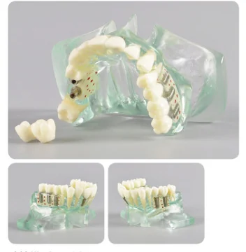 TJ-M2015 dental teaching model photo