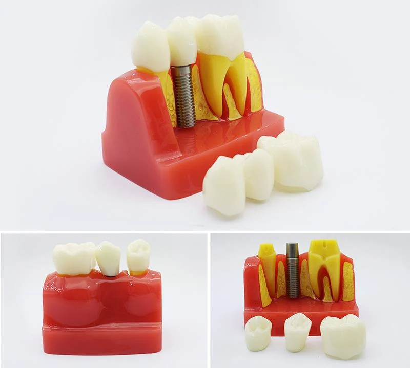 TJ-M3 dental teaching model photo