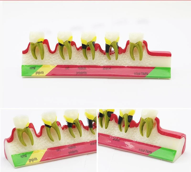 TJ-M8 dental teaching model photo