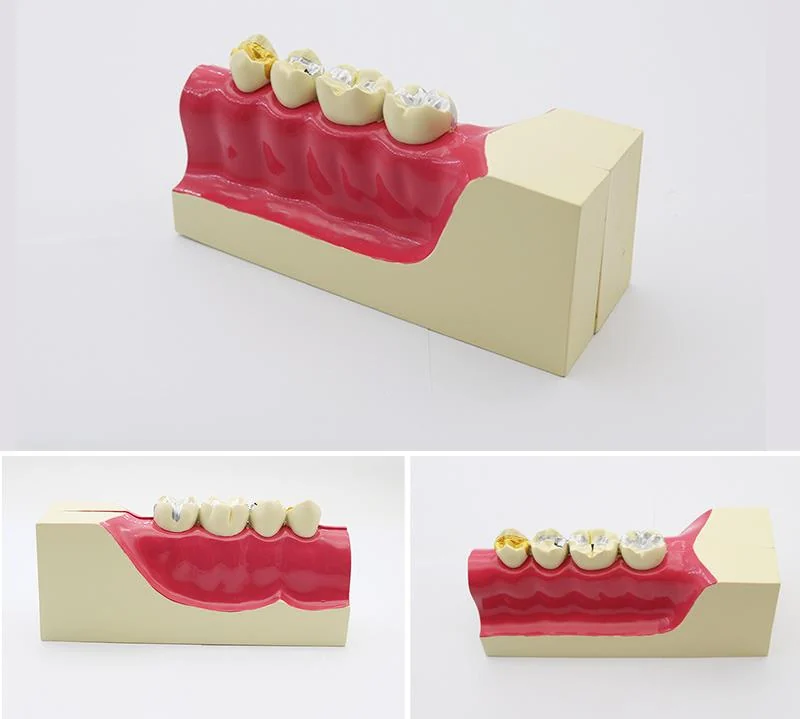 TJ-M9 dental teaching model photo