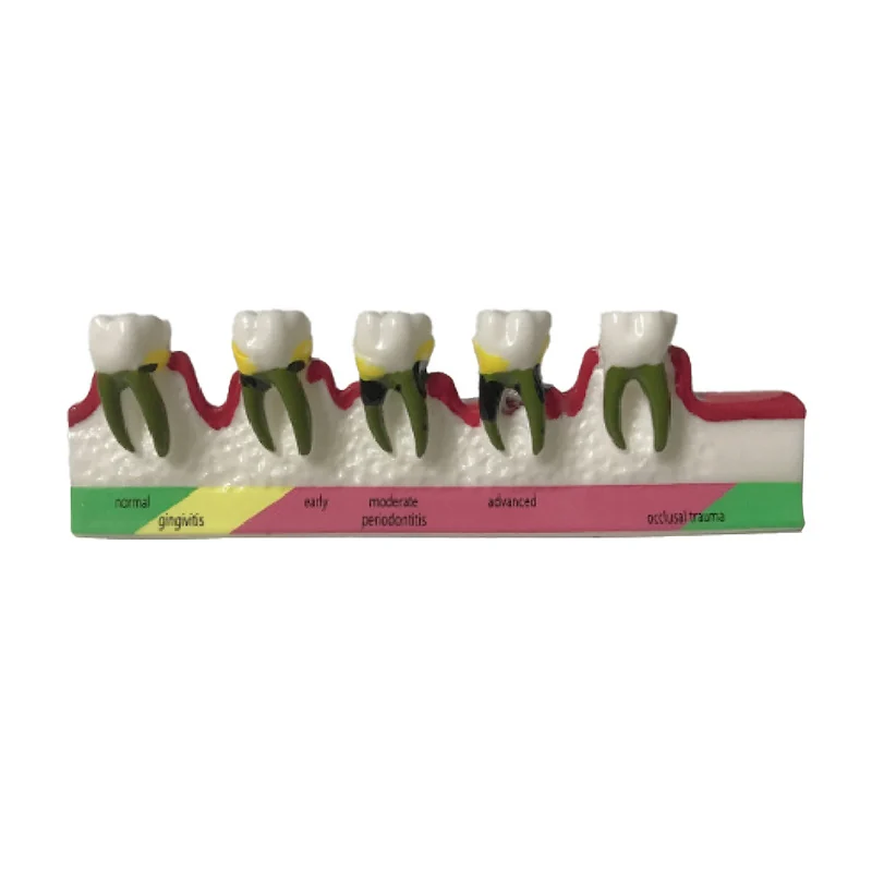 TJ-YR dental teaching model photo
